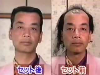 Image of a balding Japanese using comb-over technique to ‘grow’ hair.